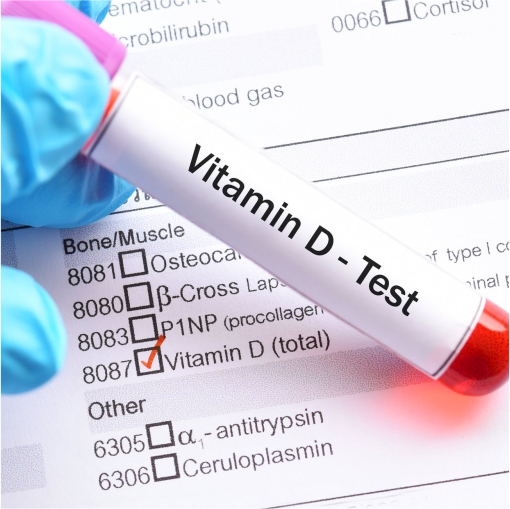 Набор реагентов для определения 25-OH витамина D